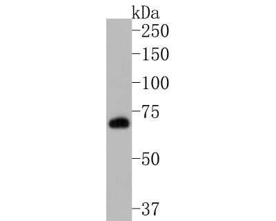 Western Blot: PKC zeta [p Thr560] Antibody (SN0753) [NBP2-67713] - Analysis of PKC zeta [p Thr560] on SK-Br-3 cell lysates. Proteins were transferred to a PVDF membrane and blocked with 5% BSA in PBS for 1 hour at room temperature. The primary antibody (1/500) was used in 5% BSA at room temperature for 2 hours. Goat Anti-Rabbit IgG - HRP Secondary Antibody at 1:200,000 dilution was used for 1 hour at room temperature.