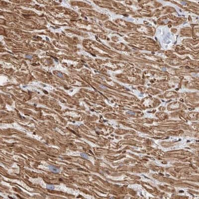 Immunohistochemistry-Paraffin: PKD1L1 Antibody [NBP1-87219] - Staining of human heart shows moderate  cytoplasmic positivity in cardiomyocytes.