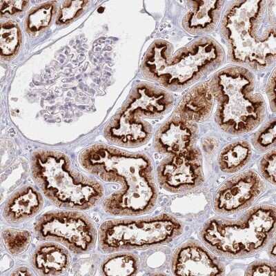 Immunohistochemistry PKD2L2 Antibody - BSA Free