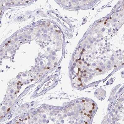 Immunohistochemistry-Paraffin PKDREJ Antibody - BSA Free