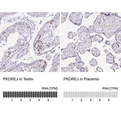 Immunohistochemistry-Paraffin PKDREJ Antibody - BSA Free