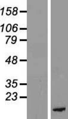 Western Blot: PKI-beta Overexpression Lysate (Adult Normal) [NBP2-04879] Left-Empty vector transfected control cell lysate (HEK293 cell lysate); Right -Over-expression Lysate for PKI-beta.