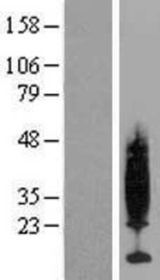 Western Blot: PKIG Overexpression Lysate (Adult Normal) [NBP2-10049] Left-Empty vector transfected control cell lysate (HEK293 cell lysate); Right -Over-expression Lysate for PKIG.