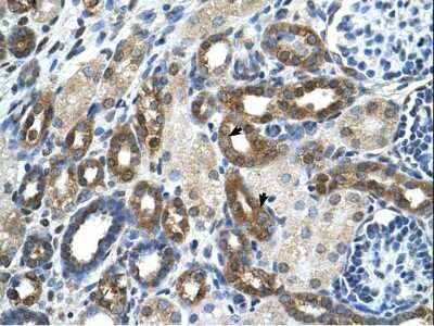 Immunohistochemistry-Paraffin: PKLR Antibody [NBP1-56319] - Human kidney lysate tissue at an antibody concentration of 4-8ug/ml.