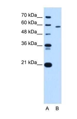 Western Blot: PKLR Antibody [NBP1-56319] - HepG2 cell lysate, concentration 1.0ug/ml.