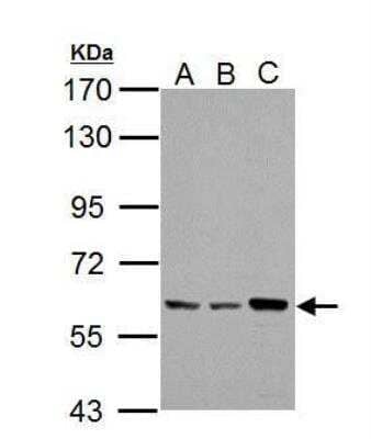 Western Blot: PKLR Antibody [NBP2-20027] - Sample (30 ug of whole cell lysate)    A: Jurkat    B: Raji    C: K562   7.5% SDS PAGE  diluted at 1:1000 