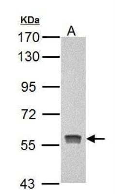 Western Blot: PKLR Antibody [NBP2-20027] - A. 20 ug Rat liver lysate/extract  7.5% SDS-PAGE  Pyruvate Kinase (liver/RBC) antibody dilution: 1:10000 