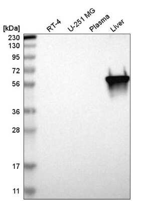 Western Blot: PKLR Antibody [NBP2-58892] - Analysis in human cell line RT-4, human cell line U-251 MG, human plasma and human liver tissue.