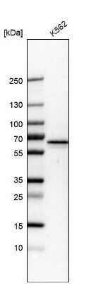 Western Blot: PKLR Antibody [NBP2-58892] - Analysis in human cell line K562.