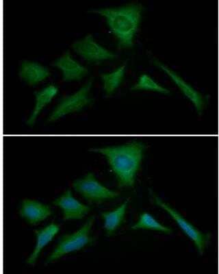 Immunocytochemistry/Immunofluorescence: PKM2 Antibody (1B10) [NBP2-42686] - Analysis of PKM2 in HeLa cells line, stained with DAPI (Blue) for nucleus staining and monoclonal anti-human PKM2 antibody (1:100) with goat anti-mouse IgG-Alexa fluor 488 conjugate (Green).