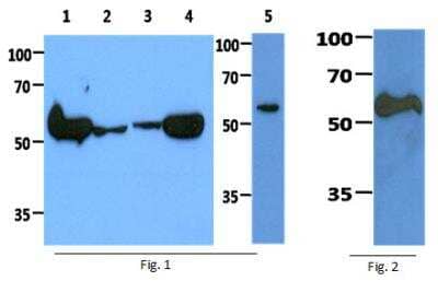 Western Blot: PKM2 Antibody (1B10) [NBP2-42686] - Fig 1: The cell lysates (40ug) were resolved by SDS-PAGE, transferred to PVDF membrane and probed with anti-human PKM2 antibody (1:1000). Proteins were visualized using a goat anti-mouse secondary antibody conjugated to HRP and an ECL detection system.  Lane 1 : HeLa cell lysate   Lane 2 : Jurkat cell lysate   Lane 3 : MCF7 cell lysate   Lane 4 : A549 cell lysate   Lane 5 : 293T cell lysate  Fig 2: The Recombinant human PKM2 (50ng) protein was resolved by SDS-PAGE, transferred to PVDF membrane and probed with anti-human PKM2 antibody (1:1000). Proteins were visualized using a goat anti-mouse secondary antibody conjugated to HRP and an ECL detection system.