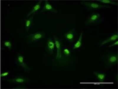 Immunocytochemistry/Immunofluorescence: PKM2 Antibody (2D8) [H00005315-M08] - Analysis of monoclonal antibody to PKM2 on HeLa cell. Antibody concentration 10 ug/ml