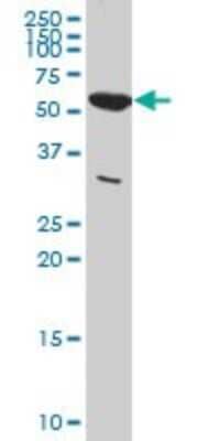 Western Blot: PKM2 Antibody (5D2-3B3) [H00005315-M01A] - PKM2 monoclonal antibody (M01A), clone 5D2-3B3 Analysis of PKM2 expression in HeLa.