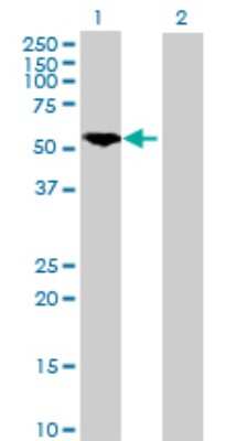 Western Blot: PKM2 Antibody [H00005315-D01P] - Analysis of PKM2 expression in transfected 293T cell line by PKM2 polyclonal antibody.Lane 1: PKM2 transfected lysate(57.90 KDa).Lane 2: Non-transfected lysate.