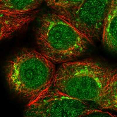 Immunocytochemistry/Immunofluorescence: PKMYT1 Antibody [NBP2-56978] - Staining of human cell line MCF7 shows localization to nucleus, nucleoli & the Golgi apparatus.