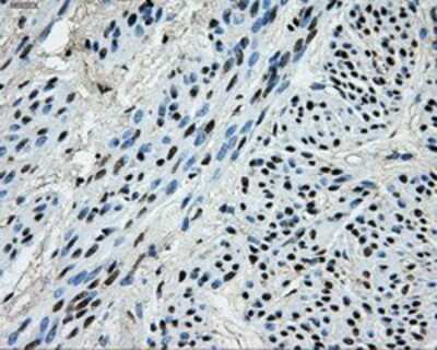 Immunohistochemistry: PKMYT1 Antibody (OTI5E1) - Azide and BSA Free [NBP2-73452] - Staining of paraffin-embedded Human endometrium tissue using anti-PKMYT1 mouse monoclonal antibody.