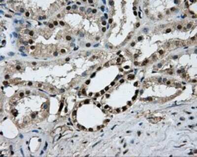 Immunohistochemistry: PKMYT1 Antibody (OTI5E1) - Azide and BSA Free [NBP2-73452] - Staining of paraffin-embedded Human Kidney tissue using anti-PKMYT1 mouse monoclonal antibody.