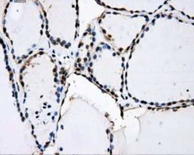 Immunohistochemistry: PKMYT1 Antibody (OTI5E1) - Azide and BSA Free [NBP2-73452] - Staining of paraffin-embedded Human thyroid tissue using anti-PKMYT1 mouse monoclonal antibody.