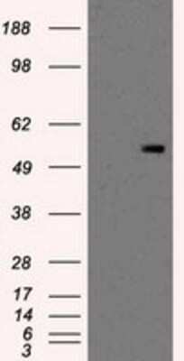 Western Blot: PKMYT1 Antibody (OTI5E1) - Azide and BSA Free [NBP2-73452] - HEK293T cells were transfected with the pCMV6-ENTRY control (Left lane) or pCMV6-ENTRY PKMYT1 (Right lane) cDNA for 48 hrs and lysed. Equivalent amounts of cell lysates (5 ug per lane) were separated by SDS-PAGE and immunoblotted with anti-PKMYT1.