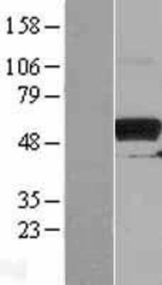 Western Blot PKMYT1 Overexpression Lysate