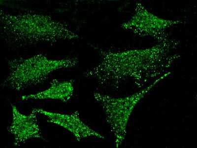 Immunocytochemistry/Immunofluorescence: PKN1 Antibody [NBP2-98761] - Immunofluorescence staining of PKN1 in Hela cells. Cells were fixed with 4% PFA, permeabilzed with 0.3% Triton X-100 in PBS, blocked with 10% serum, and incubated with rabbit anti-HUMAN PKN1 polyclonal antibody (dilution ratio 1:300) at 4C overnight. Then cells were stained with the Alexa Fluor(R)488-conjugated Goat Anti-rabbit IgG Secondary antibody (green).Positive staining was localized to cytoplasm and nucleus.