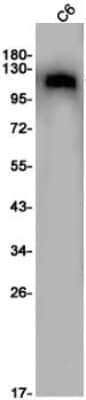 Western Blot: PKN1 Antibody (S09-2I4) [NBP3-19741] - Western blot detection of PKN1 in C6 cell lysates using NBP3-19741 (1:1000 diluted). Predicted band size: 104KDa. Observed band size: 120KDa.