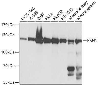 Western Blot: PKN1 Antibody [NBP2-95113] - Analysis of extracts of various cell lines, using PKN1 at 1:1000 dilution. Secondary antibody: HRP Goat Anti-Rabbit IgG (H+L) at 1:10000 dilution. Lysates/proteins: 25ug per lane. Blocking buffer: 3% nonfat dry milk in TBST. Detection: ECL Basic Kit . Exposure time: 5s.