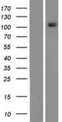 Western Blot: PKN1 Overexpression Lysate (Adult Normal) [NBP2-08073] Left-Empty vector transfected control cell lysate (HEK293 cell lysate); Right -Over-expression Lysate for PKN1.