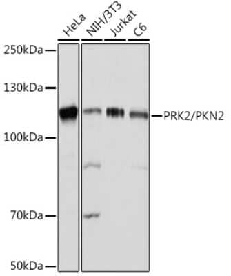 Western Blot: PKN2 Antibody (5O2G6) [NBP3-15891] - Western blot analysis of extracts of various cell lines, using PRK2/PKN2 Rabbit mAb (NBP3-15891) at 1:1000 dilution. Secondary antibody: HRP Goat Anti-Rabbit IgG (H+L) at 1:10000 dilution. Lysates/proteins: 25ug per lane. Blocking buffer: 3% nonfat dry milk in TBST. Detection: ECL Basic Kit. Exposure time: 1s.