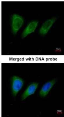 Immunocytochemistry/Immunofluorescence: PKN2 Antibody [NBP1-31367] - Paraformaldehyde-fixed HeLa, using antibody at 1:200 dilution.