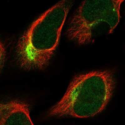 Immunocytochemistry/Immunofluorescence: PKN2 Antibody [NBP2-13766] - Staining of human cell line U-2 OS shows localization to nucleoplasm & intermediate filaments.