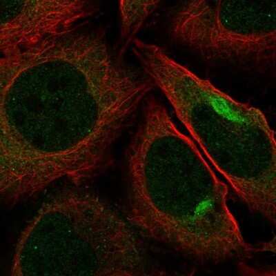 Immunocytochemistry/Immunofluorescence: PKN2 Antibody [NBP2-68736] - Staining of human cell line U-2 OS shows localization to nuclear bodies, cytosol & intermediate filaments.