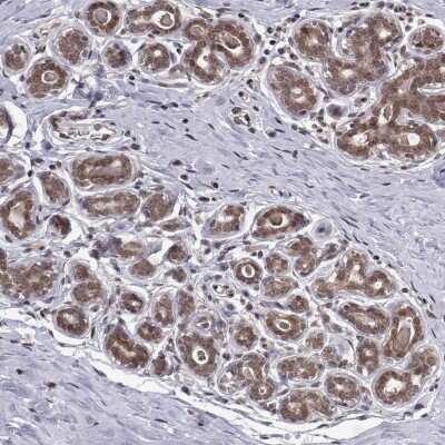 Immunocytochemistry/Immunofluorescence: PKN2 Antibody [NBP2-68736] - Immunohistochemical staining of human breast shows moderate cytoplasmic and nuclear positivity in glandular cells.