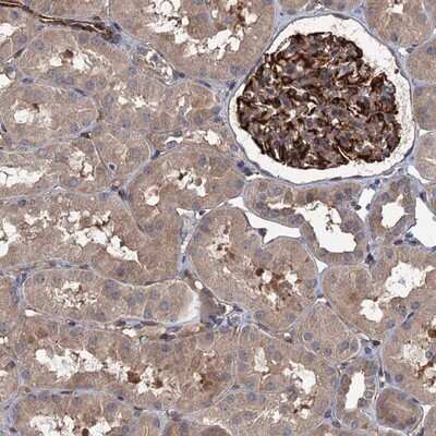 Immunohistochemistry-Paraffin: PKN2 Antibody [NBP2-13766] - Staining of human kidney shows strong cytoplasmic positivity in glomeruli.