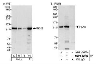 Western Blot: PKN2 Antibody [NBP1-30086] - Whole cell lysate from HeLa and 293T cells. PKN2 was also immunoprecipitated by rabbit anti-PKN2 antibody NBP1-30084. For blotting IPed PKN2, the ReliaBLOT(R)  Reagents and Procedures were used.