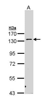 Western Blot: PKN2 Antibody [NBP1-31367] - Sample (30 ug of whole cell lysate) A: H1299 7. 5% SDS PAGE; antibody diluted at 1:1000.