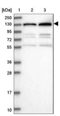 Western Blot: PKN2 Antibody [NBP2-13766] - Lane 1: Marker  [kDa] 250, 130, 95, 72, 55, 36, 28, 17, 10.  Lane 2: Human cell line RT-4.  Lane 3: Human cell line U-251MG sp