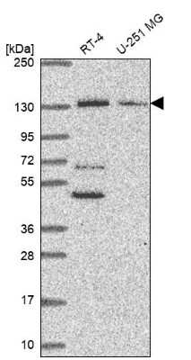 Western Blot: PKN2 Antibody [NBP2-68736] - Analysis in human cell line RT-4 and human cell line U-251 MG.