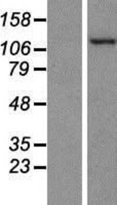 Western Blot: PKN2 Overexpression Lysate (Adult Normal) [NBP2-07651] Left-Empty vector transfected control cell lysate (HEK293 cell lysate); Right -Over-expression Lysate for PKN2.