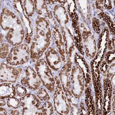 Immunohistochemistry-Paraffin PKN3 Antibody - BSA Free