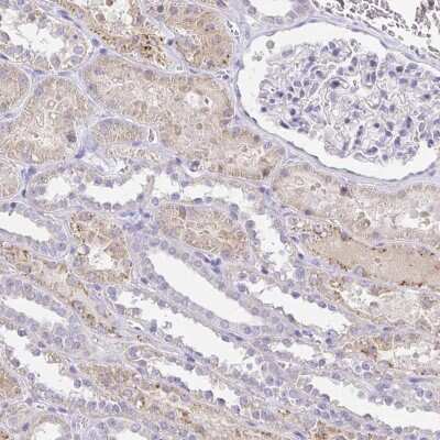 Immunohistochemistry-Paraffin: PKN3 Antibody [NBP2-38849] - Staining of human kidney shows moderate cytoplasmic positivity renal tubules.