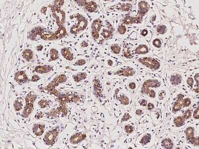 Immunohistochemistry-Paraffin: PKN3 Antibody [NBP2-98608] - Immunochemical staining of human PKN3 in human breast with rabbit polyclonal antibody at 1:100 dilution, formalin-fixed paraffin embedded sections.