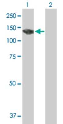 Western Blot PKN3 Antibody - Azide and BSA Free