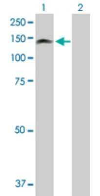 Western Blot: PKN3 Antibody [H00029941-D01P] - Analysis of PKN3 expression in transfected 293T cell line by PKN3 polyclonal antibody.Lane 1: PKN3 transfected lysate(99.40 KDa).Lane 2: Non-transfected lysate.
