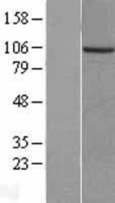 Western Blot PKN3 Overexpression Lysate