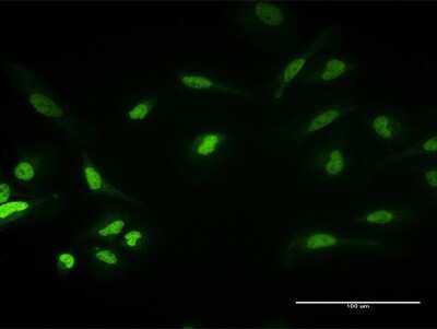 Immunocytochemistry/Immunofluorescence: PKNOX1 Antibody [H00005316-B02P] - Analysis of purified antibody to PKNOX1 on HeLa cell. (antibody concentration 10 ug/ml)