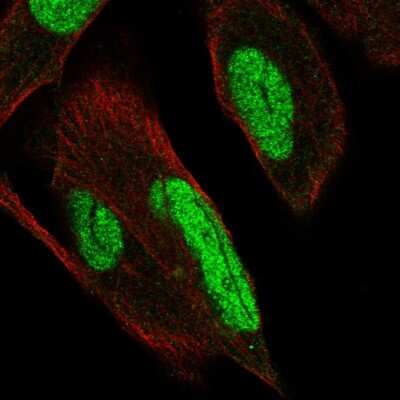 Immunocytochemistry/Immunofluorescence: PKNOX1 Antibody [NBP2-57710] - Staining of human cell line RH-30 shows localization to nucleoplasm & centrosome.