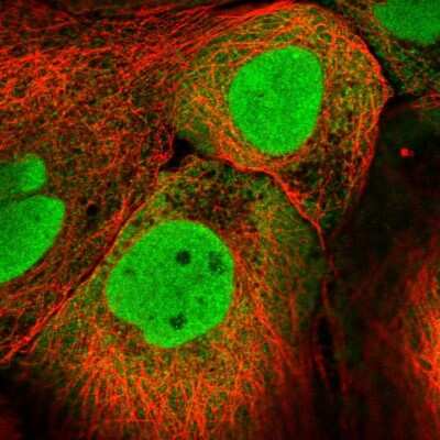 Immunocytochemistry/Immunofluorescence: PKNOX1 Antibody [NBP2-58191] - Staining of human cell line A-431 shows localization to nucleoplasm & cytosol.