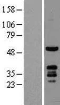 Western Blot: PKNOX1 Overexpression Lysate (Adult Normal) [NBL1-14465] Left-Empty vector transfected control cell lysate (HEK293 cell lysate); Right -Over-expression Lysate for PKNOX1.