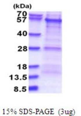 SDS-Page: PKNOX1 Recombinant Protein [NBP2-51713] - 15% SDS Page (3 ug)